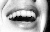 גוף האדם - שיניים – הספרייה הלאומית
