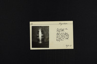 Beschneidungsbecher - Gunzenhausen (Germany).